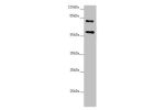 Western blot<br />
All lanes:CEP83 antibody at 2.41 ug/ml+ Raji whole cell lysate<br />
Secondary<br />
Goat polyclonal to rabbit IgG at 1/10000 dilution<br />
Predicted band size: 83,68 kDa<br />
Observed band size: 82,55 kDa<br />