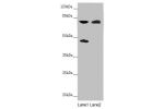 Western blot<br />
All lanes:CEP83 antibody at 2.27 ug/ml<br />
Lane 1 : Mouse liver tissue<br />
Lane 2 : COLO205 whole cell lysate<br />
Secondary<br />
Goat polyclonal to rabbit IgG at 1/10000 dilution<br />
Predicted band size: 83,68 kDa<br />
Observe