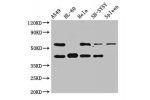 Western Blot<br />
Positive WB detected in:A549 whole cell lysate,HL-60 whole cell lysate,Hela whole cell lysate,SH-SY5Y whole cell lysate,Rat spleen tissue<br />
All lanes:BACE2 antibody at 2.5