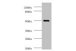 Western blot<br />
All lanes:Actin-like protein 7A antibody at 2ug/ml+mouse liver tissue<br />
Secondary<br />
Goat polyclonal to rabbit at 1/10000 dilution<br />
Predicted band size: 49kDa<br />
Observed band size: 49kDa<br />