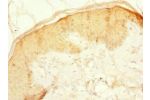 Immunohistochemistry of paraffin-embedded human skin tissue using CSB-PA896752ESR1HU at dilution 1:100
