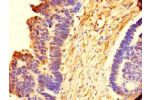 Immunohistochemistry of paraffin-embedded human ovarian tissue using CSB-PA896753LA01HU at dilution of 1:100