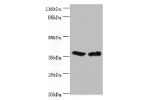 Western blot<br />
All lanes:CA5B antibody at 2ug/ml<br />
Lane 1:mouse liver tissue<br />
Lane 2:mouse kidney tissue<br />
Secondary<br />
Goat polyclonal to rabbit at 1/10000 dilution<br />
Predicted band size: 36kDa<br />
Observed band size: 36kDa<br /