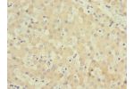 Immunohistochemistry of paraffin-embedded human liver tissue CSB-PA896885LA01HU at dilution 1:100