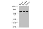 Western Blot<br />
Positive WB detected in:Mouse kidney tissue,Mouse stomach tissue,Mouse thymus tissue<br />
All lanes: COL4A3BP antibody at 3.4ug/ml<br />
Secondary<br />
Goat polyclonal to rabbit IgG at 1/50000 dilution<br />
Predicted band size: 71,69