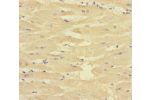 Immunohistochemistry of paraffin-embedded human heart tissue using CSB-PA896913ESR2HU at dilution of 1:100