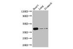 Western Blot<br />
Positive WB detected in:Mouse heart tissue,Mouse lung tissue,Mouse stomach tissue<br />
All lanes: DMRT1 antibody at 3ug/ml<br />
Secondary<br />
Goat polyclonal to rabbit IgG at 1/50000 dilution<br />
Predicted band size: 40,29,19 kDa<