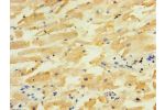 Immunohistochemistry of paraffin-embedded human heart tissue using CSB-PA896924LA01HU at dilution of 1:100