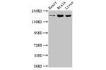 Western Blot<br />
Positive WB detected in:Rat heart tissue,Mouse brain tissue,Mouse liver tissue<br />
All lanes:ARFGEF2 antibody at 3.2