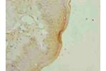 Immunohistochemistry of paraffin-embedded human skin tissue using CSB-PA897103LA01HU at dilution of 1:100
