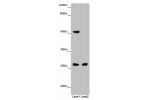 Western blot<br />
All lanes: CHTOP antibody at 14 ug/ml<br />
Lane 1 : Mouse heart tissue<br />
Lane 2 : Mouse kidney tissue<br />
Secondary<br />
Goat polyclonal to rabbit IgG at 1/10000 dilution<br />
Predicted band size: 27,22 kDa<br />
Observed band 