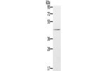 Gel: 8%SDS-PAGE, Lysate: 40 