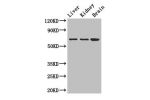 Western Blot<br />
Positive WB detected in:Mouse liver tissue,Mouse kidney tissue,Mouse brain tissue<br />
All lanes: AK5 antibody at 2.5ug/ml<br />
Secondary<br />
Goat polyclonal to rabbit IgG at 1/50000 dilution<br />
Predicted band size: 64,22,61 kDa<