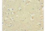 Immunohistochemistry of paraffin-embedded human brain tissue using CSB-PA897318ESR1HU at dilution 1:100