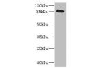 Western blot<br />
All lanes: CDH10 antibody IgG at 3.58ug/ml+ Rat heart tissue<br />
Secondary<br />
Goat polyclonal to rabbit IgG at 1/10000 dilution<br />
Predicted band size: 88 kDa<br />
Observed band size: 88 kDa<br />