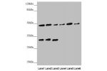 Western blot<br />
All lanes: BCS1L antibody at 5.04 ug/ml<br />
Lane 1 : Mouse kidney tissue<br />
Lane 2 : Mouse liver tissue<br />
Lane 3 : Mouse brain tissue<br />
Lane 4 : A549 whole cell lysate<br />
Lane 5 : 293T whole cell lysate<br />
Lane 6 : He