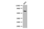 Western Blot<br />
Positive WB detected in:K562 whole cell lysate<br />
All lanes: BTRC antibody at 2.8ug/ml<br />
Secondary<br />
Goat polyclonal to rabbit IgG at 1/50000 dilution<br />
Predicted band size: 69,66 kDa<br />
Observed band size: 69 kDa<br /