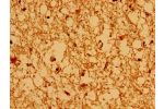 Immunohistochemistry of paraffin-embedded human brain tissue using CSB-PA897472LA01HU at dilution of 1:100