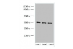 Western blot<br />
All lanes: C15orf41 antibody at 1.5ug/ml<br />
Lane 1 : K562 whole cell lysate<br />
Lane 2 : HepG-2 whole cell lysate<br />
Lane 3 : U251 whole cell lysate<br />
Secondary<br />
Goat polyclonal to Rabbit IgG at 1/10000 dilution<br />
P