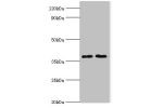 Western blot<br />
All lanes:Dehydrogenase/reductase SDR family member 7 antibody at 2ug/ml<br />
Lane 1:HepG2 whole cell lysate<br />
Lane 2:MCF-7 whole cell lysate<br />
Secondary<br />
Goat polyclonal to rabbit at 1/10000 dilution<br />
Predicted band 