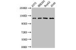 Western Blot<br />
Positive WB detected in:A375 whole cell lysate,HEK293 whole cell lysate,HepG2 whole cell lysate,A549 whole cell lysate<br />
All lanes:FARP1 antibody at 3