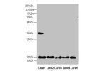 Western blot<br />
All lanes:FAM96B antibody at 7.23 ug/ml<br />
Lane 1 : Mouse gonadal tissue<br />
Lane 2 : MCF7 whole cell lysate<br />
Lane 3 : Hela whole cell lysate<br />
Lane 4 : K562 whole cell lysate<br />
Lane 5 : A375 whole cell lysate<br />
Se