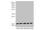 Western blot<br />
All lanes:FAM96B antibody at 7.09 ug/ml<br />
Lane 1 : Mouse gonadal tissue<br />
Lane 2 : MCF7 whole cell lysate<br />
Lane 3 : Hela whole cell lysate<br />
Lane 4 : K562 whole cell lysate<br />
Lane 5 : A375 whole cell lysate<br />
Se