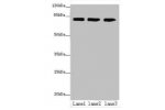 Western blot<br />
All lanes: AP4B1 antibody at 3ug/ml<br />
Lane 1 : HepG-2 whole cell lysate<br />
Lane 2 : U251 whole cell lysate<br />
Lane 3 : LO2 whole cell lysate<br />
Secondary<br />
Goat polyclonal to Rabbit IgG at 1/10000 dilution<br />
Predict