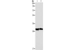 Gel: 10%SDS-PAGE, Lysate: 40 