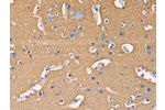 The image on the left is immunohistochemistry of paraffin-embedded Human brain tissue using CSB-PA897922(GNB1 Antibody) at dilution 1/20, on the right is treated with fusion protein. (Original magnification: 