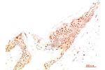 Immunohistochemical analysis of paraffin-embedded Human Skin Tissue using ATG14 Rabbit pAb diluted at 1:500