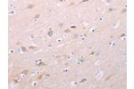 The image on the left is immunohistochemistry of paraffin-embedded Human brain tissue using CSB-PA899170(ADCY5 Antibody) at dilution 1/40, on the right is treated with synthetic peptide. (Original magnification: 