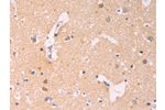 The image on the left is immunohistochemistry of paraffin-embedded Human brain tissue using CSB-PA901817(ADCY1 Antibody) at dilution 1/60, on the right is treated with synthetic peptide. (Original magnification: 