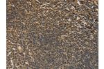 The image on the left is immunohistochemistry of paraffin-embedded Human tonsil tissue using CSB-PA903639(DACH1 Antibody) at dilution 1/50, on the right is treated with fusion protein. (Original magnification: 