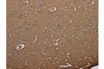 The image on the left is immunohistochemistry of paraffin-embedded Human brain tissue using CSB-PA905782(AQP4 Antibody) at dilution 1/20, on the right is treated with synthetic peptide. (Original magnification: 
