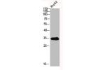 Western blot analysis of HepG2 using ASAH3 antibody.. Secondary antibody  was diluted at 1:20000