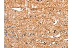 The image on the left is immunohistochemistry of paraffin-embedded Human brain tissue using CSB-PA906875(ARHGEF11 Antibody) at dilution 1/25, on the right is treated with synthetic peptide. (Original magnification: 