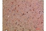 Immunohistochemical analysis of paraffin-embedded human-brain, antibody was diluted at 1:200