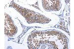 The image on the left is immunohistochemistry of paraffin-embedded Human testis tissue using CSB-PA907350(FABP3 Antibody) at dilution 1/17, on the right is treated with synthetic peptide. (Original magnification: 