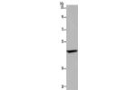 Gel: 8%SDS-PAGE, Lysate: 40 