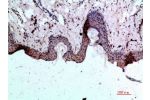 Immunohistochemical analysis of paraffin-embedded human-skin, antibody was diluted at 1:200