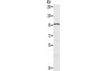 Gel: 6%SDS-PAGE, Lysate: 40 