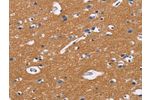 The image on the left is immunohistochemistry of paraffin-embedded Human brain tissue using CSB-PA911004(CD47 Antibody) at dilution 1/50, on the right is treated with synthetic peptide. (Original magnification: 
