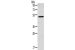 Gel: 8%SDS-PAGE,Lysate: 40 