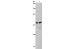 Gel: 8%SDS-PAGE, Lysate: 40 
