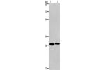 Gel: 8%SDS-PAGE, Lysate: 40 
