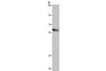 Gel: 6%SDS-PAGE, Lysate: 40 