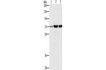 Gel: 8%SDS-PAGE, Lysate: 40 