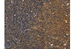 The image on the left is immunohistochemistry of paraffin-embedded Human tonsil tissue using CSB-PA919681(DCTN5 Antibody) at dilution 1/25, on the right is treated with fusion protein. (Original magnification: 