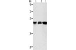 Gel: 10%SDS-PAGE, Lysate: 40 